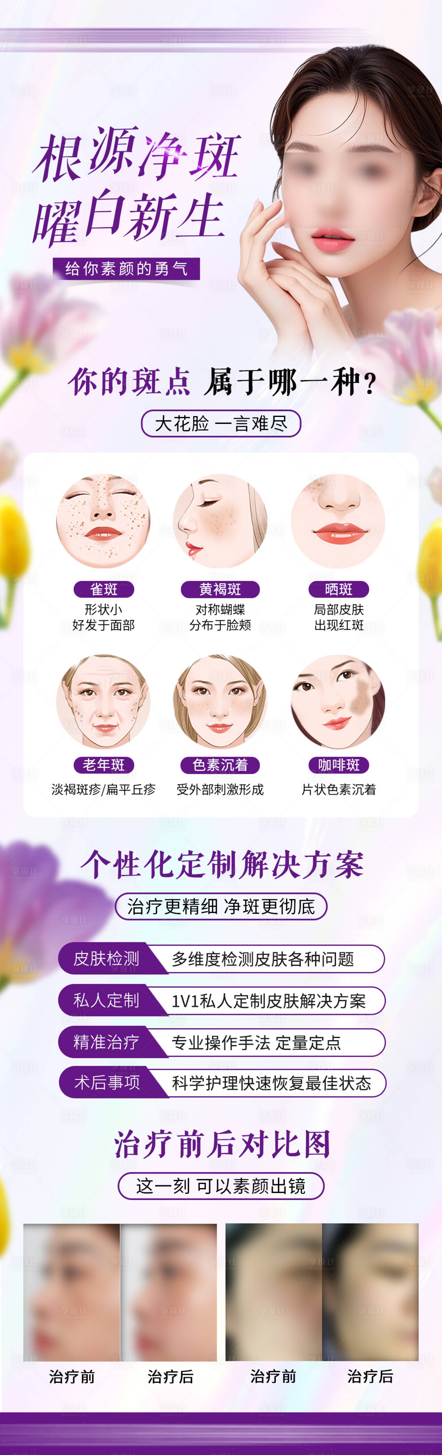 源文件下载【享设计】搜索编号：89190030918633570【祛斑宣传图】
