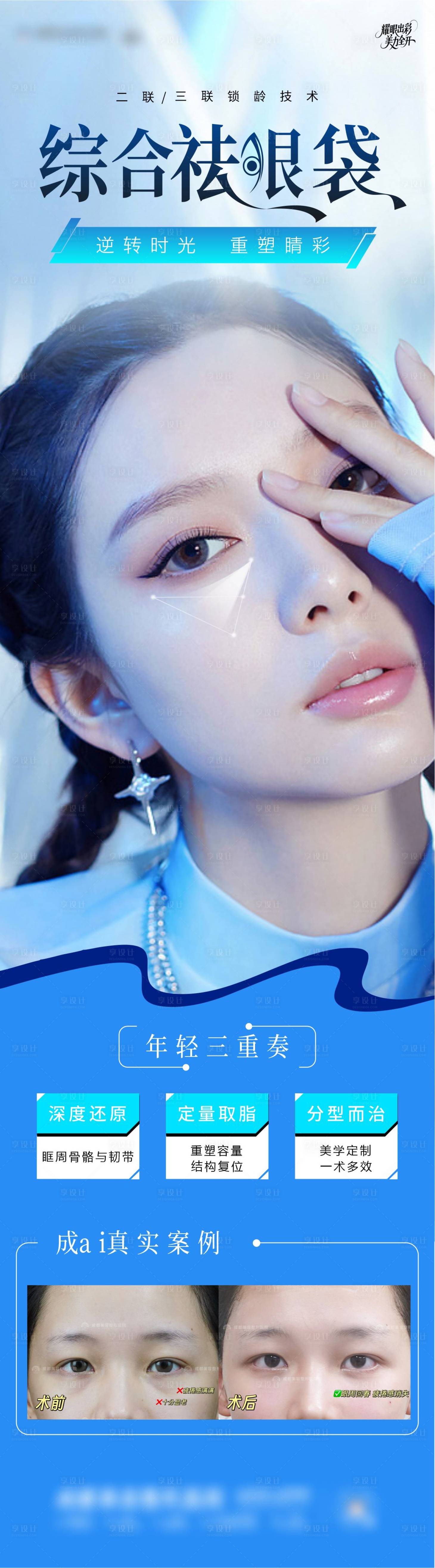 源文件下載【享設(shè)計(jì)】搜索編號(hào)：98170030674104175【綜合祛眼袋醫(yī)美宣傳海報(bào)】
