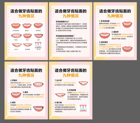 牙齿贴面小红书口腔科普