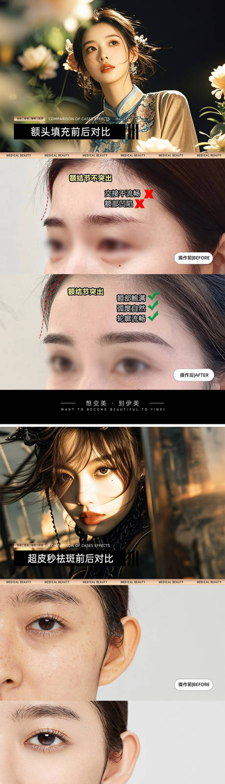 源文件下载【医美案例对比模板】编号：39760030544662620