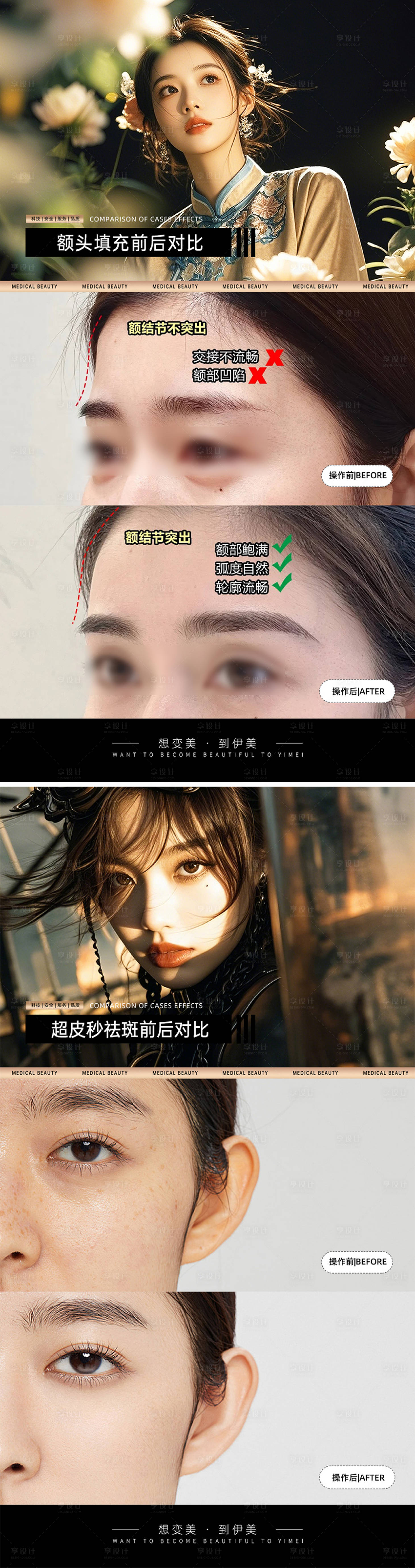 源文件下載【享設計】搜索編號：39760030544662620【醫美案例對比模板】