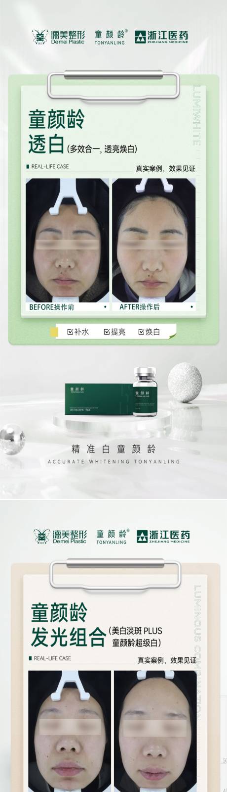 源文件下载【童颜龄案例对比海报】编号：96950030864774292