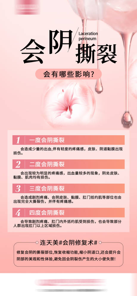 源文件下载【会阴撕裂】编号：54440030549244370