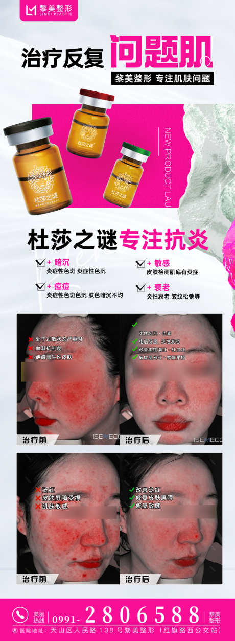 医美整形杜莎之谜消炎祛红