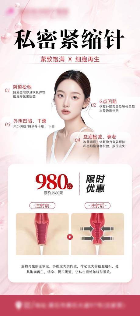 源文件下载【享设计】搜索编号：72390031026883974【私密紧缩针海报】