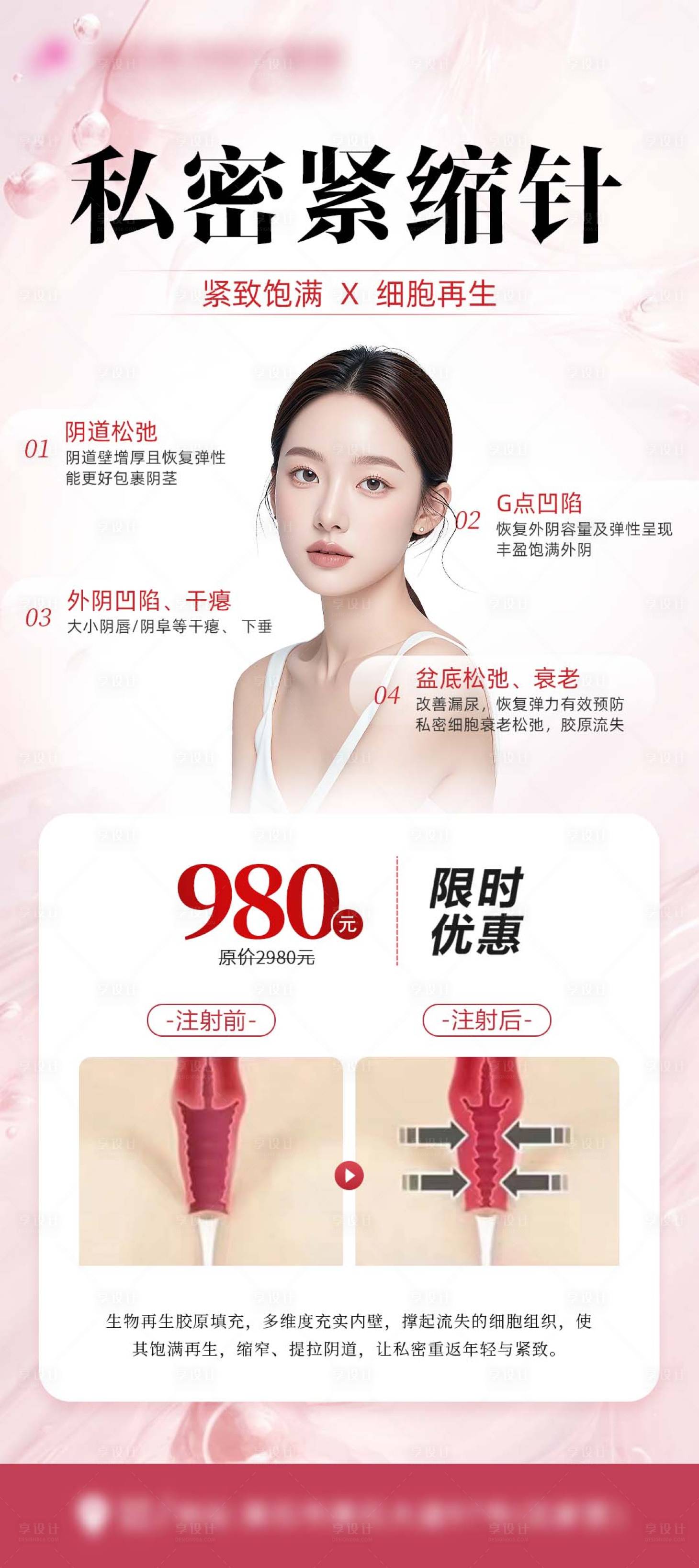 源文件下载【享设计】搜索编号：72390031026883974【私密紧缩针海报】