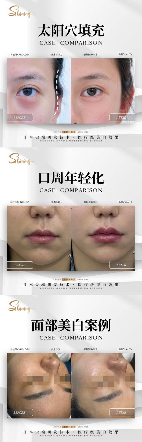 美业简约案例