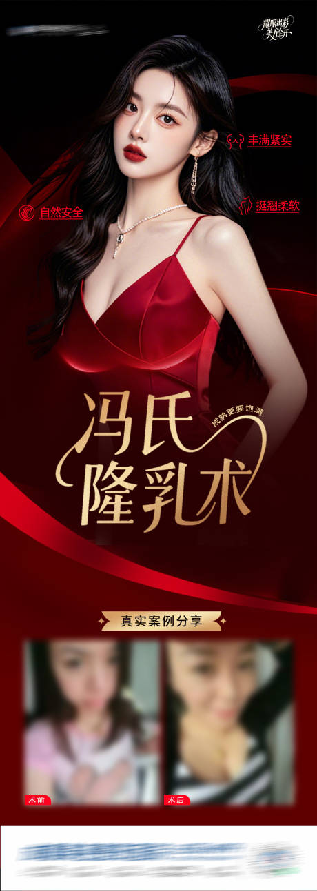源文件下载【医美隆乳术案例创意长图海报】编号：17030030609631580