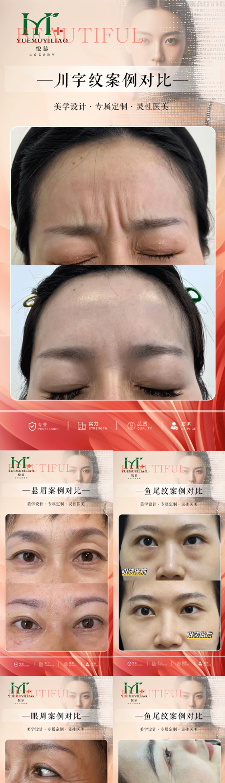 源文件下载【医美案例】编号：96360030717585885