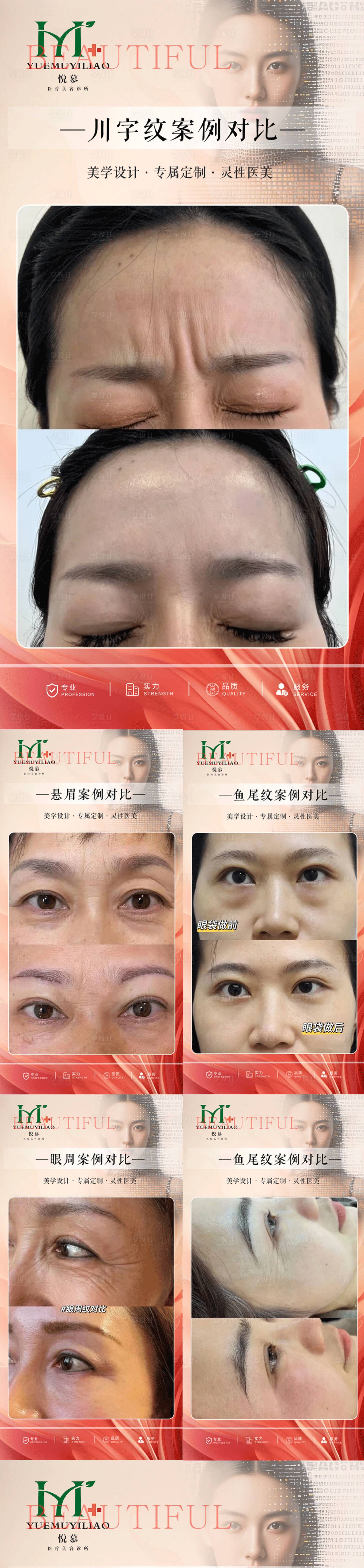 源文件下載【享設計】搜索編號：96360030717585885【醫(yī)美案例】