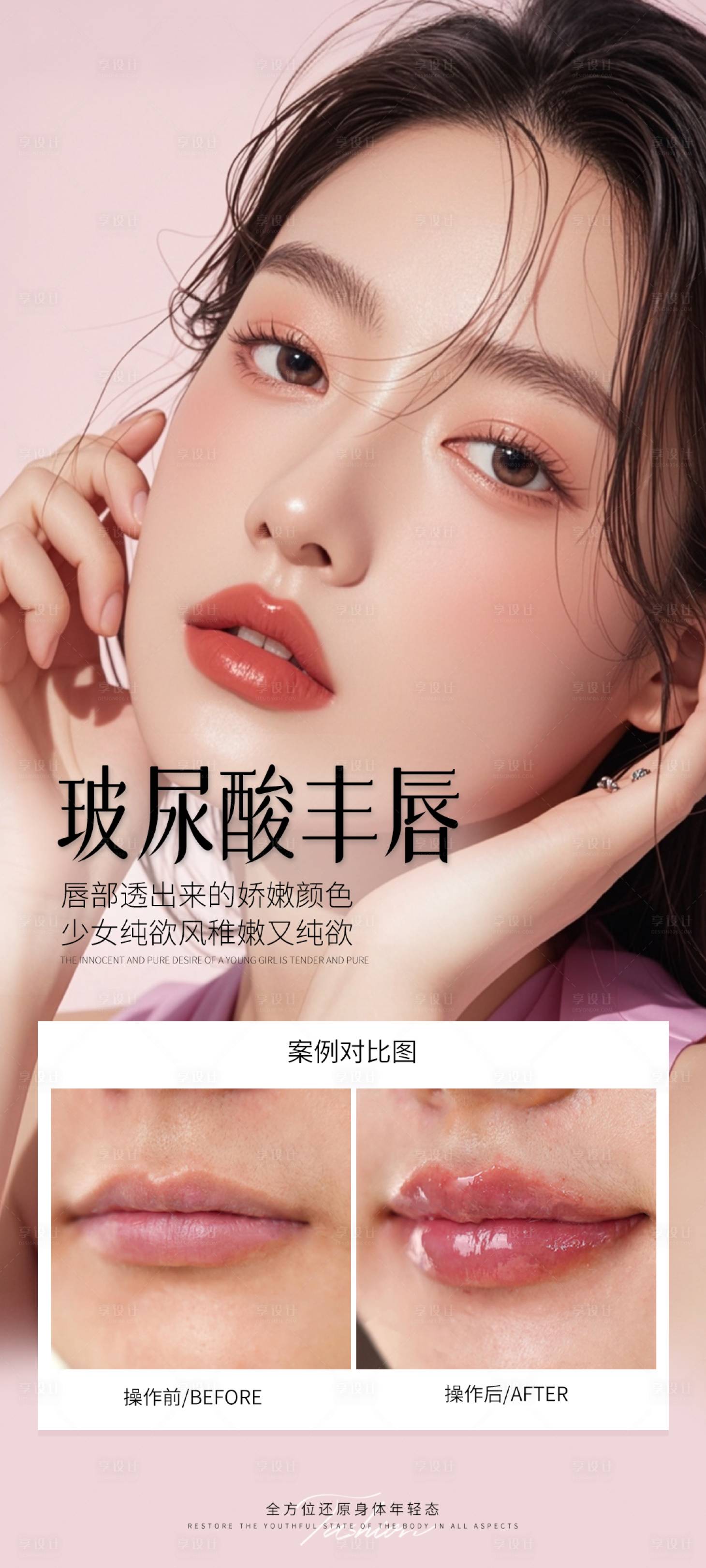 源文件下載【享設計】搜索編號：61040031009064122【醫美玻尿酸豐唇案例海報】