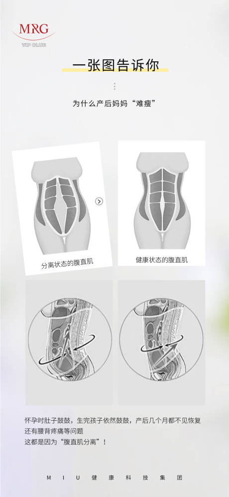 源文件下载【享设计】搜索编号：85100030903287470【产后妈妈痛点海报/腹直肌】