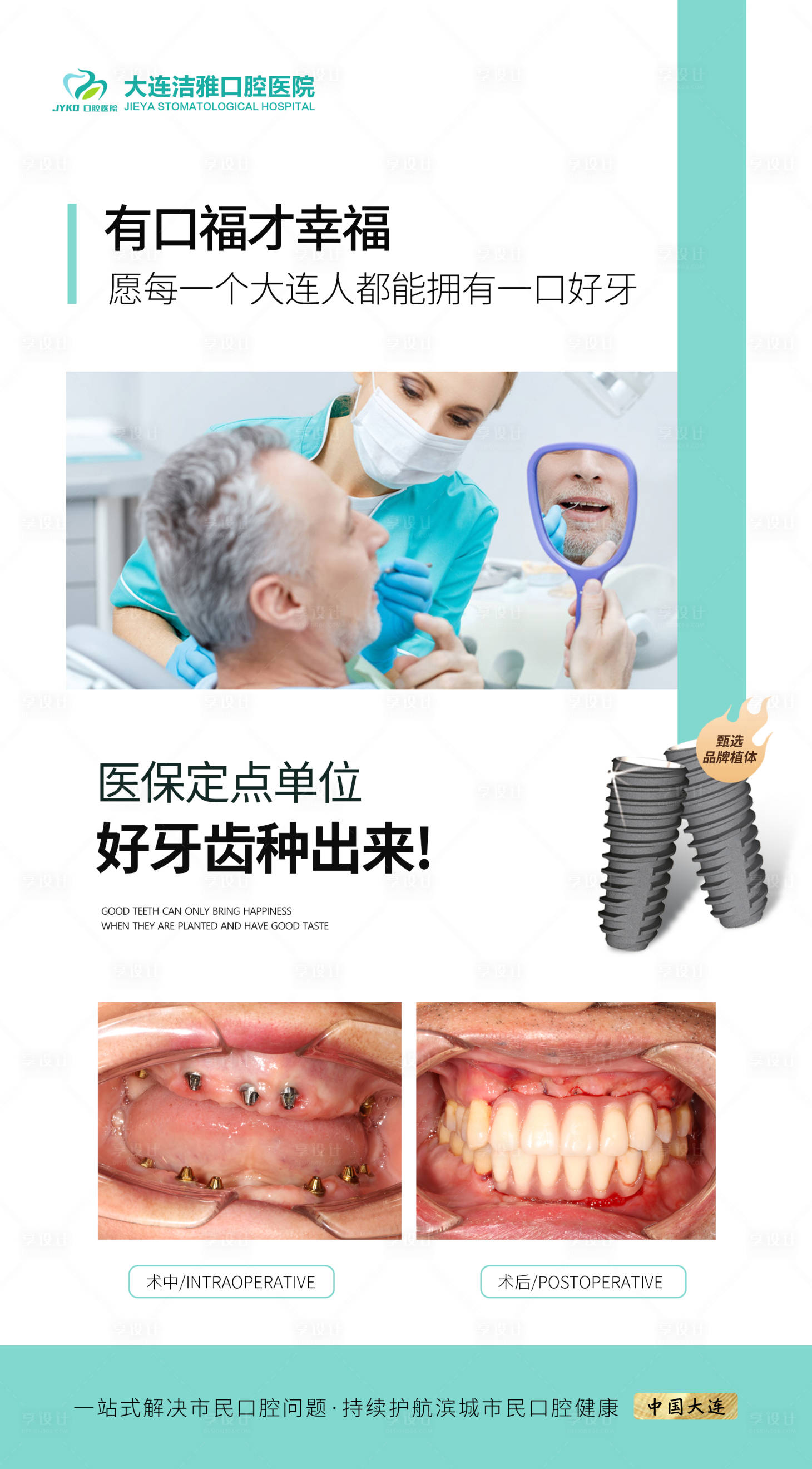 源文件下载【享设计】搜索编号：78300030572548754【口腔种植牙案例对比海报】