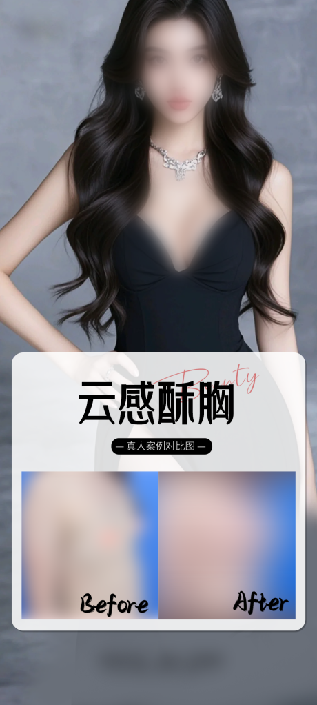 源文件下载【医美丰胸案例海报】编号：14620030851914356