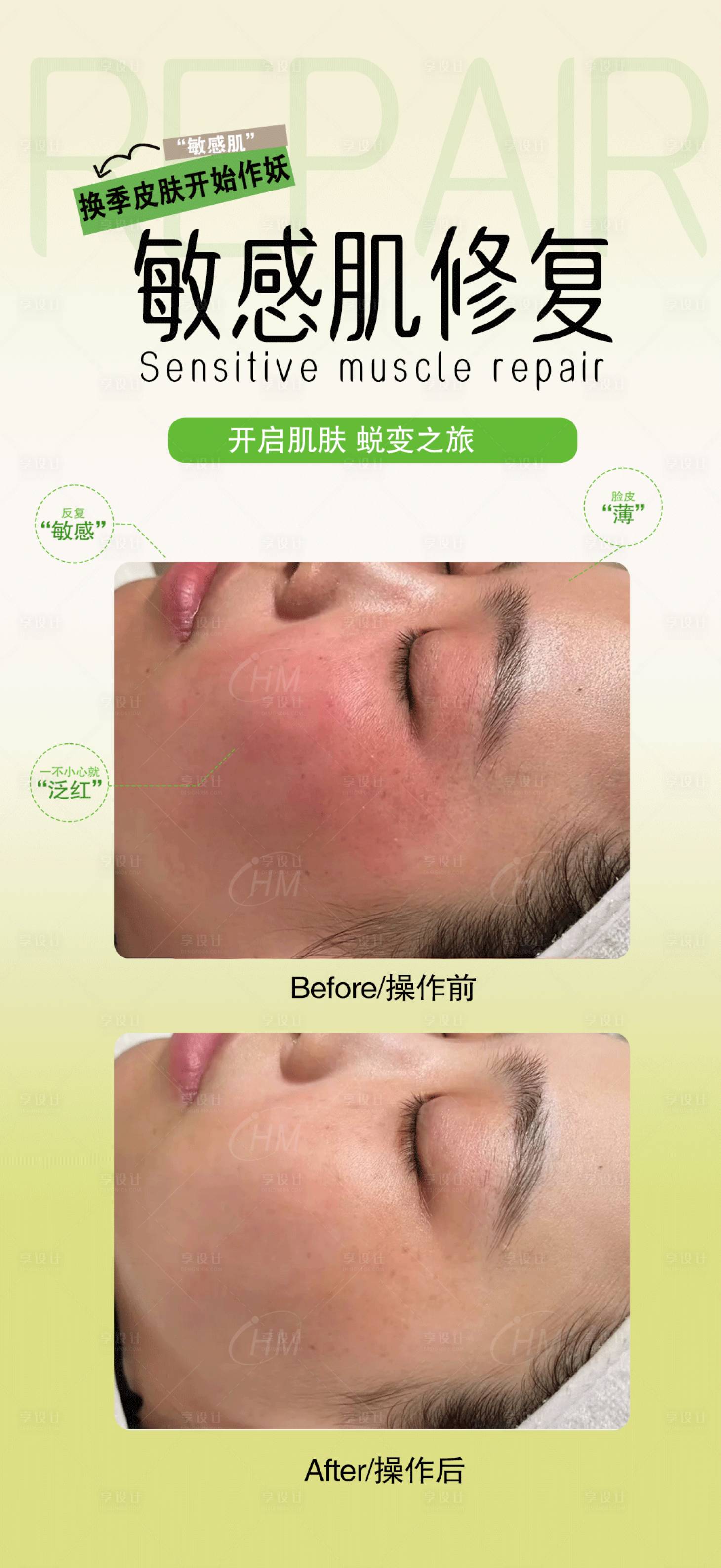 源文件下載【享設計】搜索編號：70480030527347279【敏感肌修復】