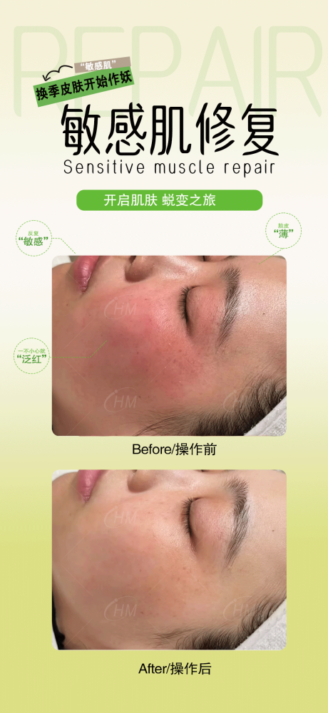敏感肌修复