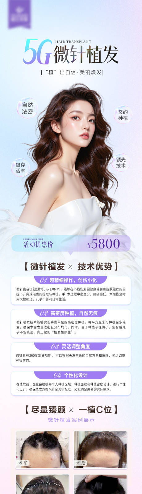源文件下载【植发活动长图】编号：52990031059149885