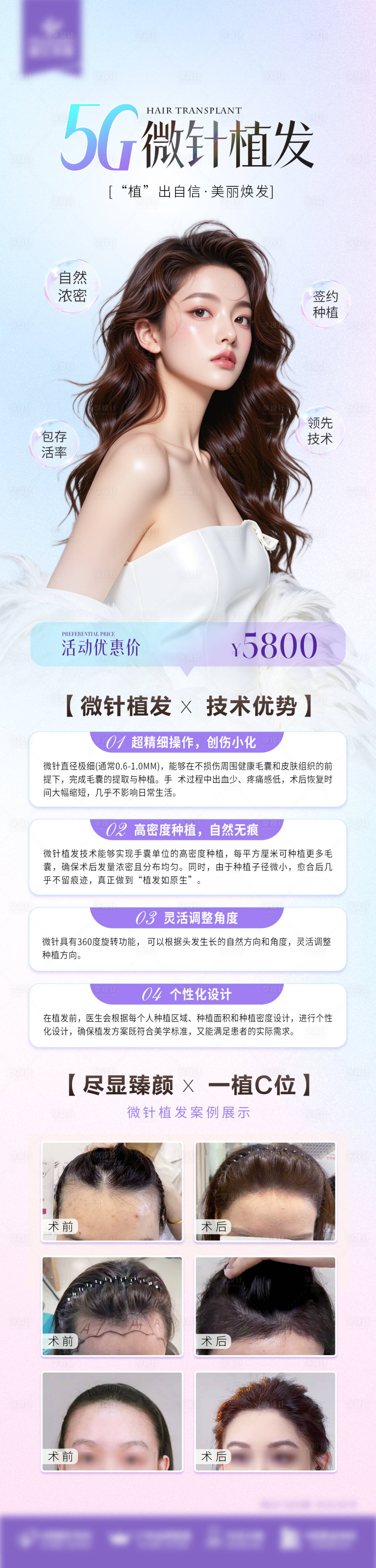 源文件下載【享設計】搜索編號：52990031059149885【植發活動長圖】