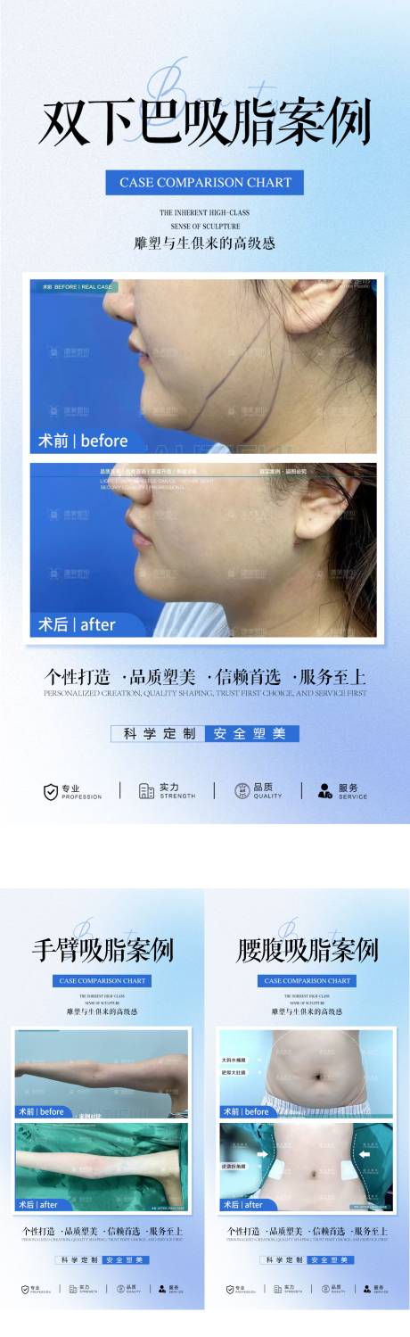 医美吸脂案例海报