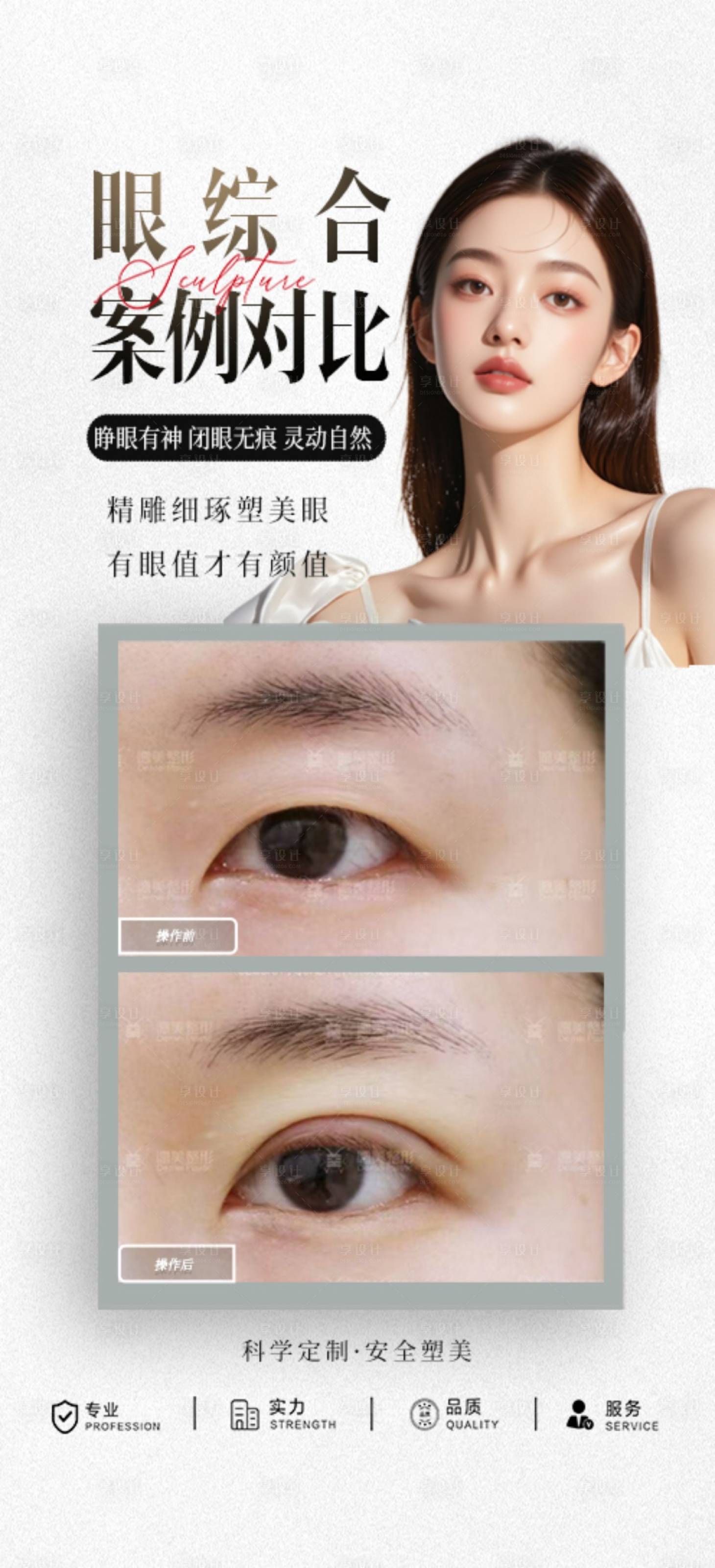 源文件下载【享设计】搜索编号：68970030521612894【眼综合案例】