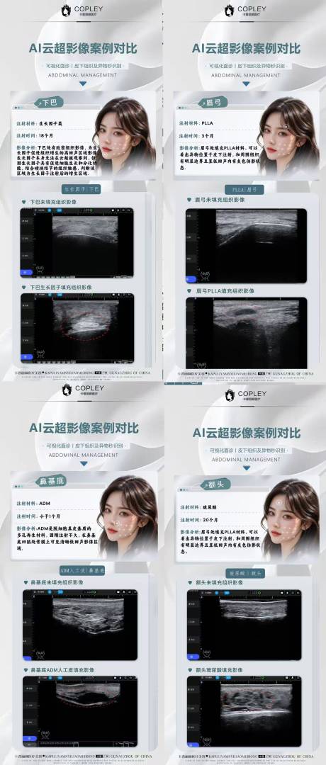 医美AI云超检测美学科普海报