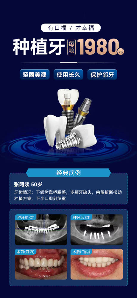 源文件下载【口腔种植牙宣传案例海报】编号：39120030960535461