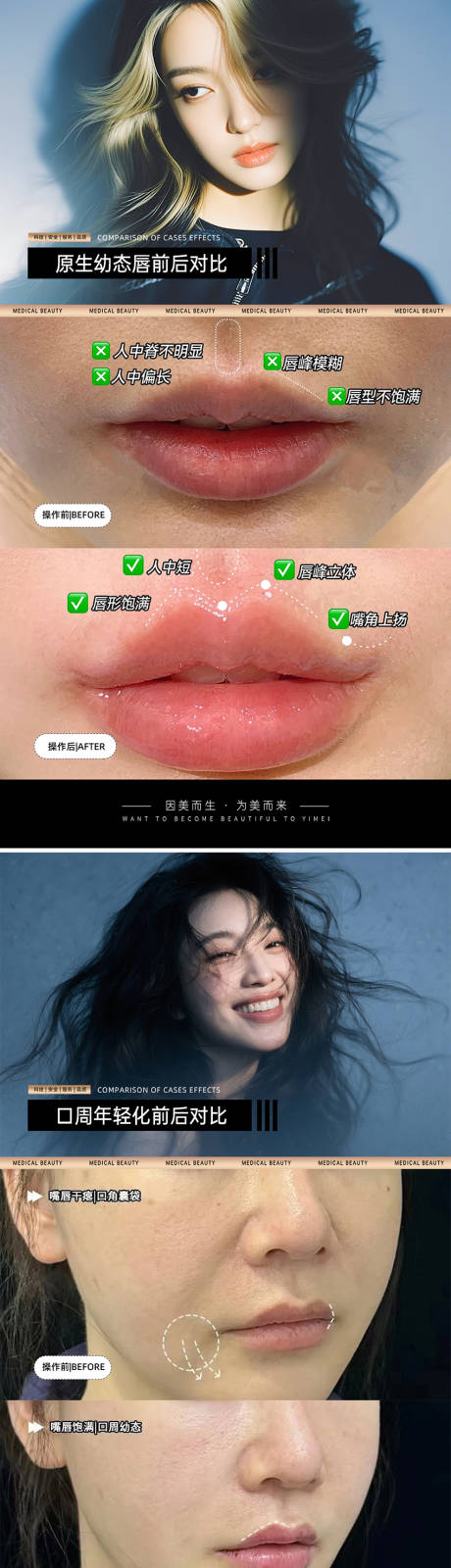 源文件下載【享設(shè)計(jì)】搜索編號(hào)：46980030763348017【醫(yī)美案例對(duì)比模板】