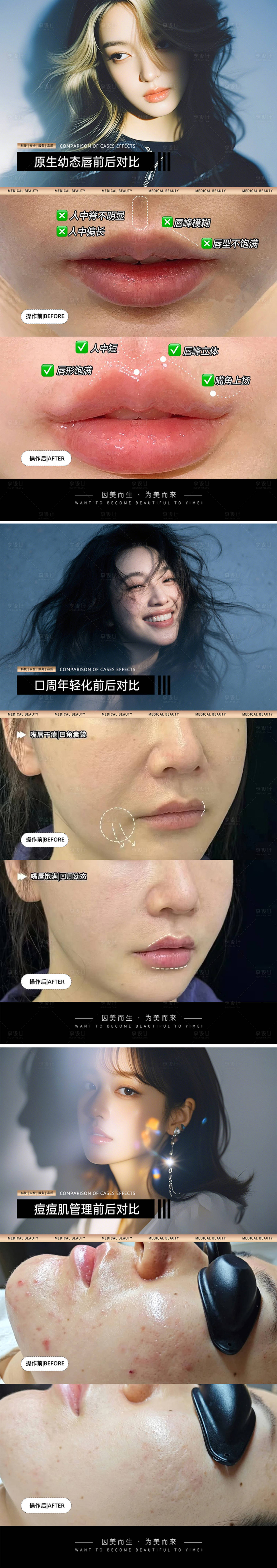 源文件下載【享設計】搜索編號：46980030763348017【醫(yī)美案例對比模板】
