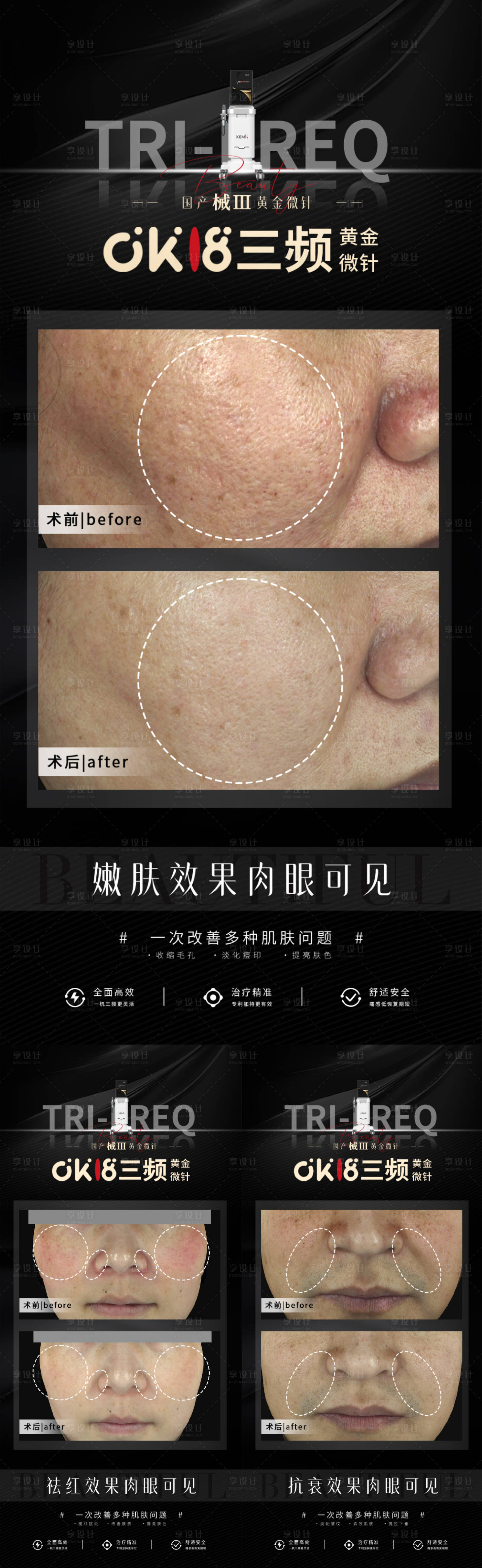 源文件下载【享设计】搜索编号：73560030703029287【黄金微针医美创意朋友圈】