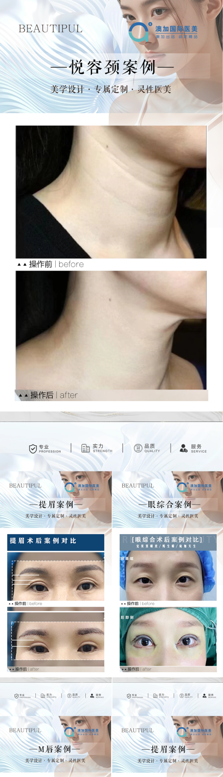 源文件下载【整形案例】编号：80880030822219149