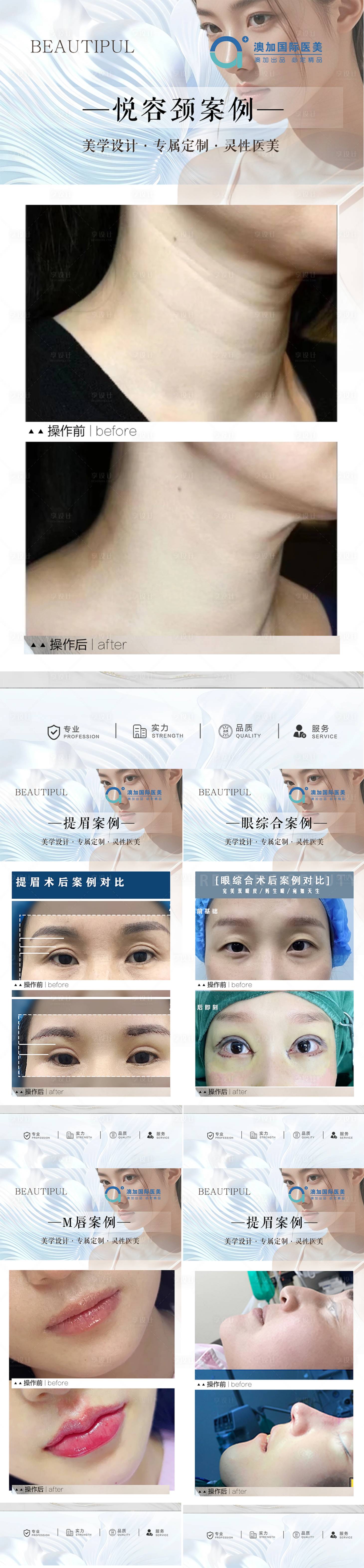 源文件下載【享設計】搜索編號：80880030822219149【整形案例】