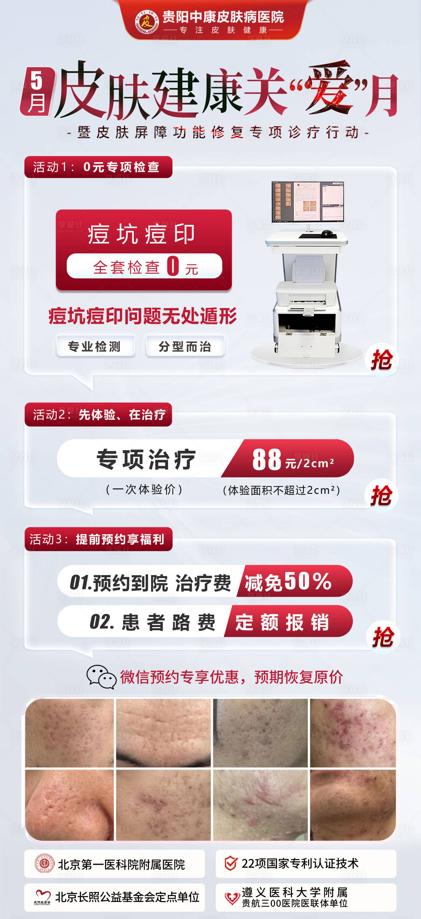 源文件下载【享设计】搜索编号：30710030644311660【医美痘坑痘印】