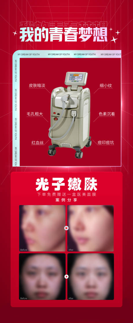 源文件下載【光子嫩膚案例海報】編號：20670030695242987