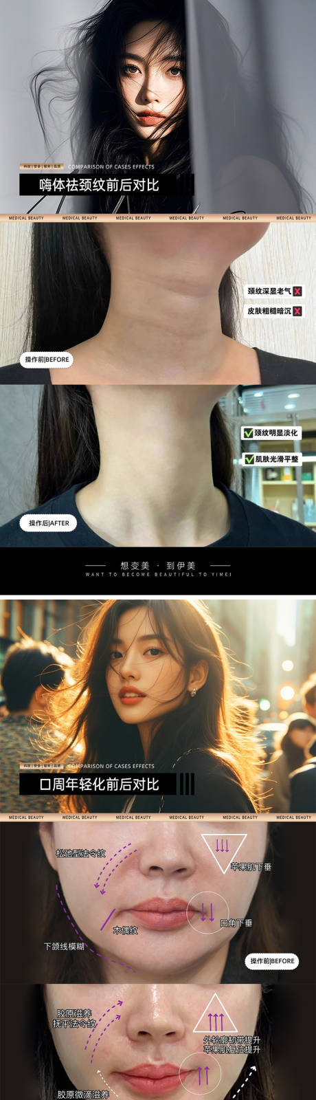医美案例对比模板