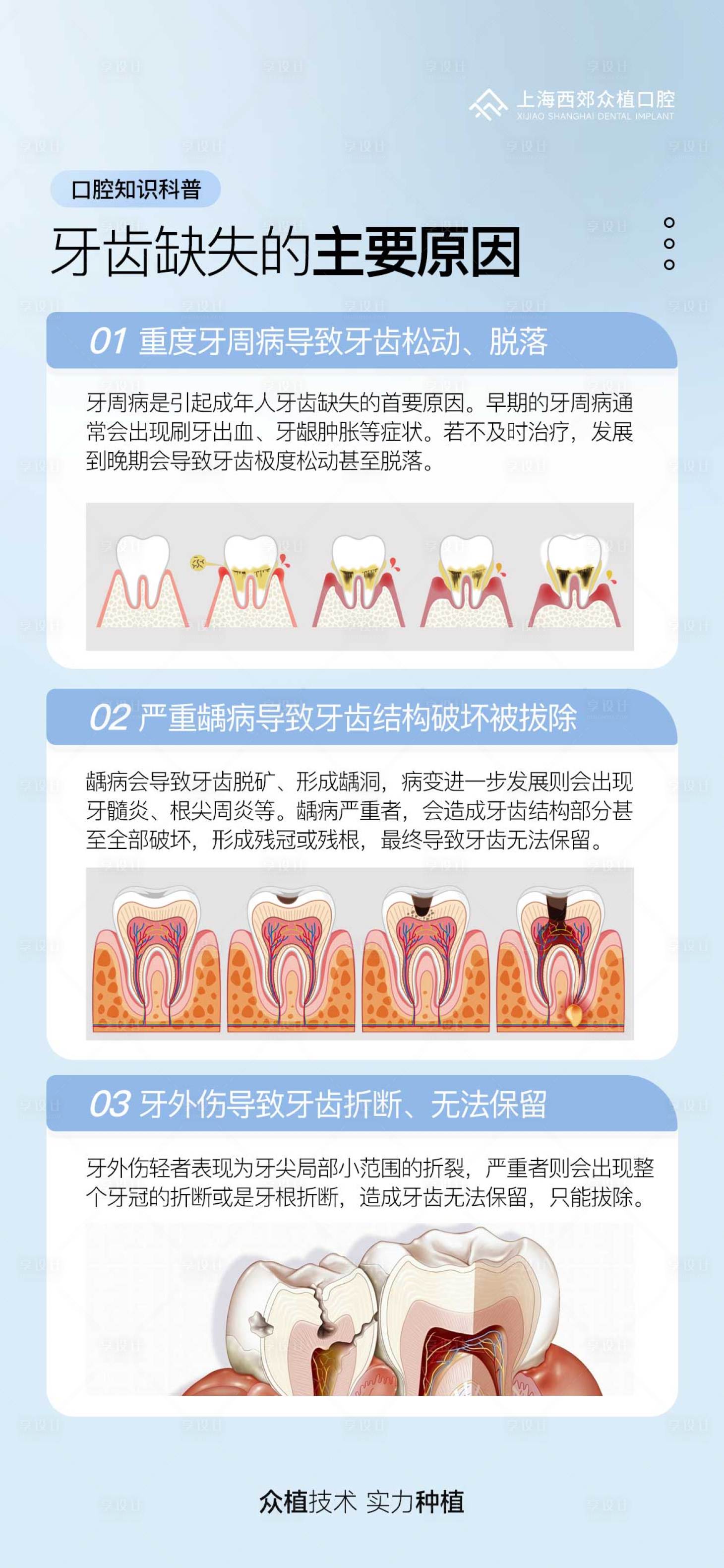 源文件下載【享設計】搜索編號：18230030895893436【牙齒缺失科普海報】