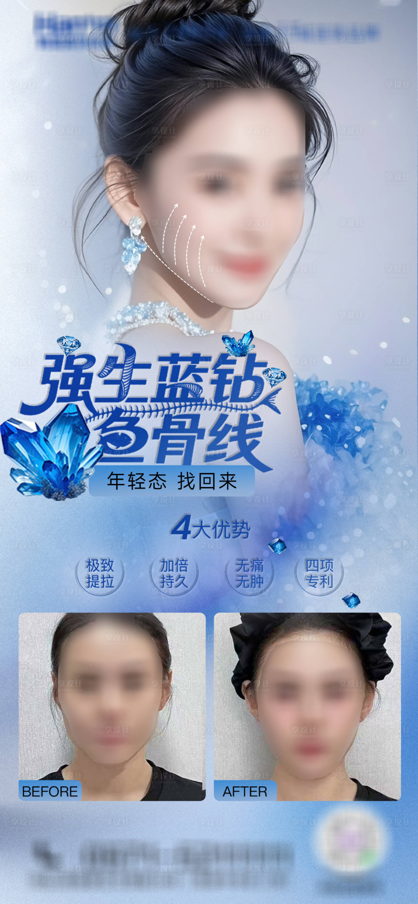 源文件下載【享設計】搜索編號：84370030915778086【醫美強生藍鉆魚骨線】