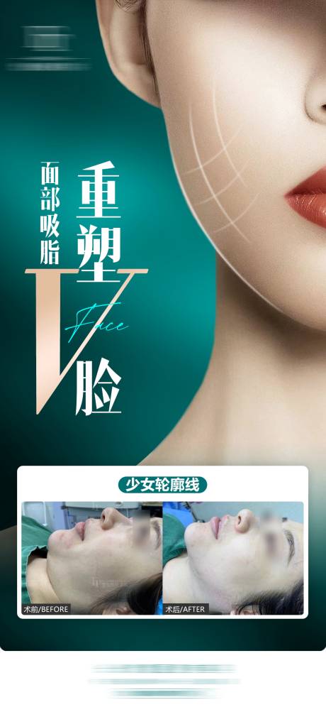 源文件下載【享設計】搜索編號：60360030841416350【重塑v臉案例海報】