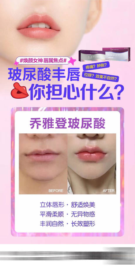 源文件下载【丰唇玻尿酸】编号：52320030660567632