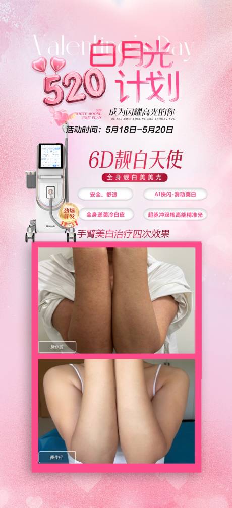 6d靓白天使美白案例海报
