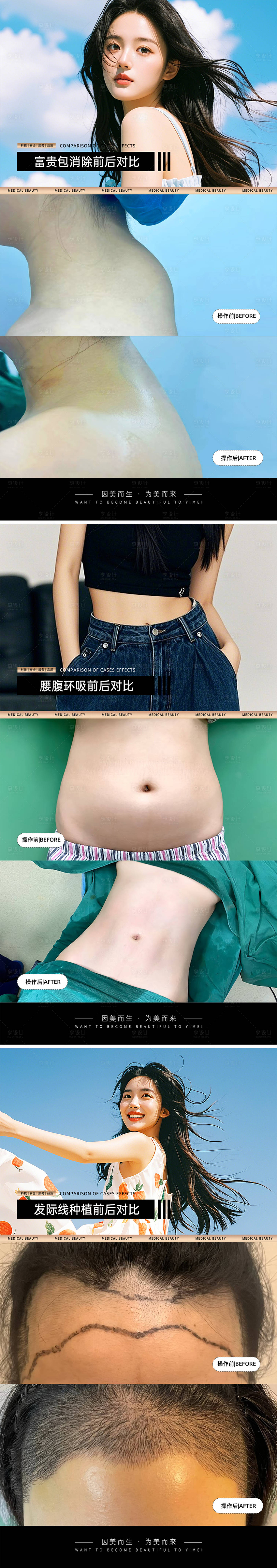 源文件下載【享設計】搜索編號：66820030978178936【醫美案例對比模板】