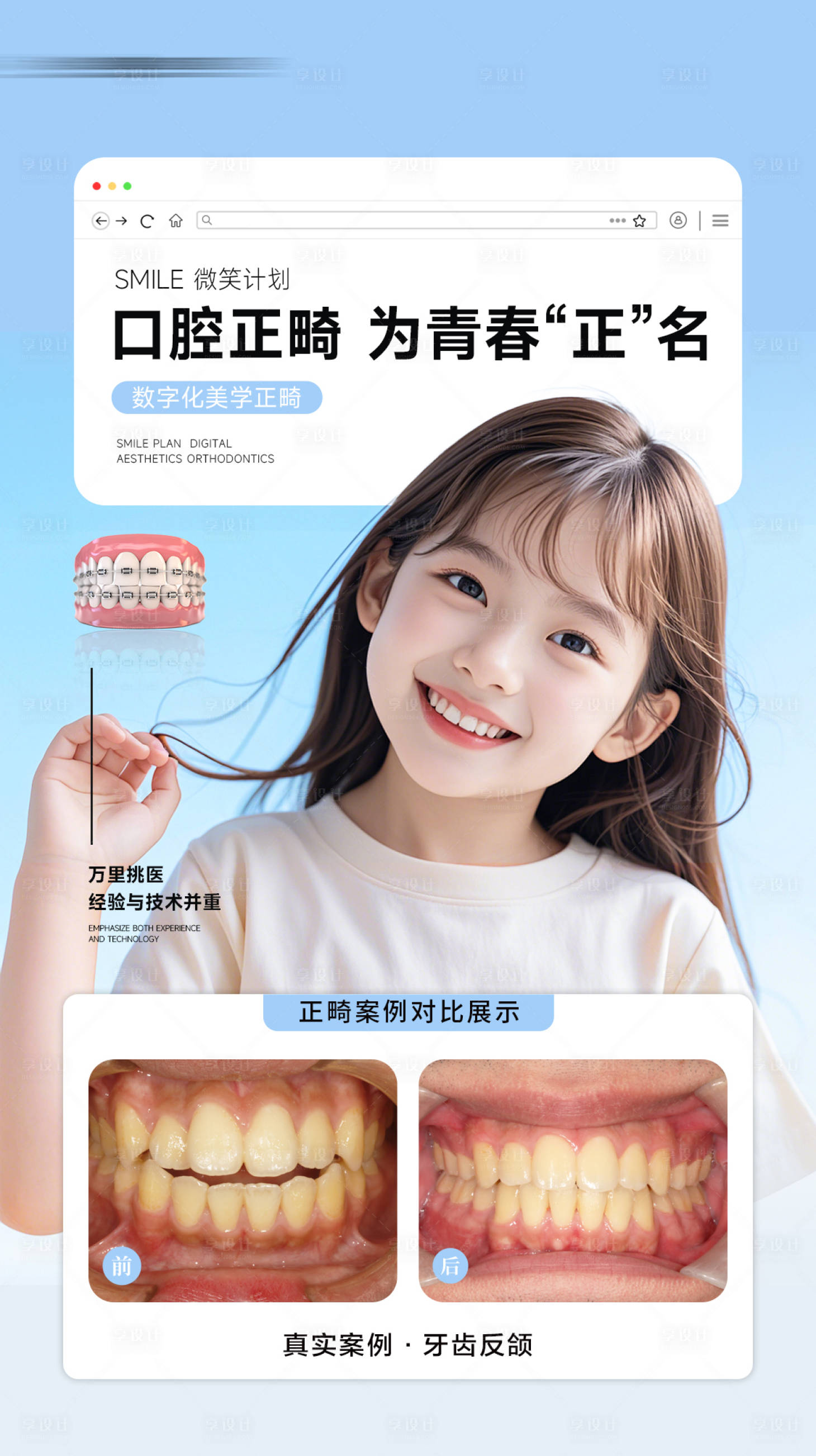 源文件下载【享设计】搜索编号：80040030523698620【口腔牙齿矫正案例对比海报】