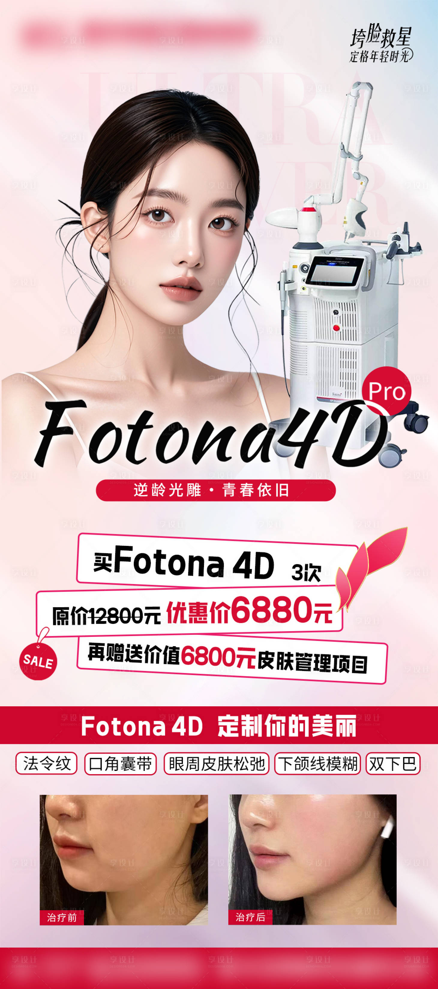 源文件下載【享設(shè)計】搜索編號：70480030928324215【fotona4D活動海報】