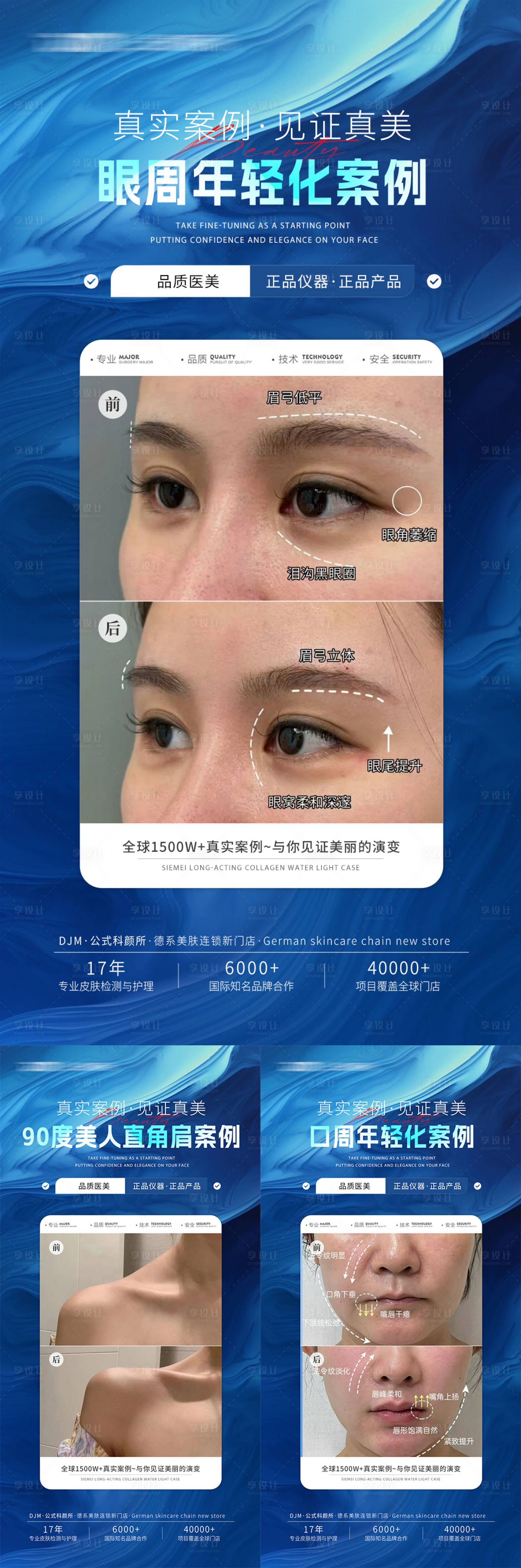源文件下載【享設(shè)計】搜索編號：80750030959586035【醫(yī)美案例對比海報】