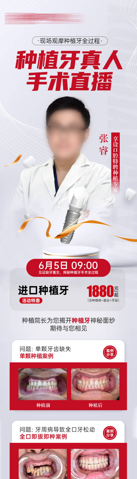 源文件下載【種植牙直播海報】編號：48130030959302324