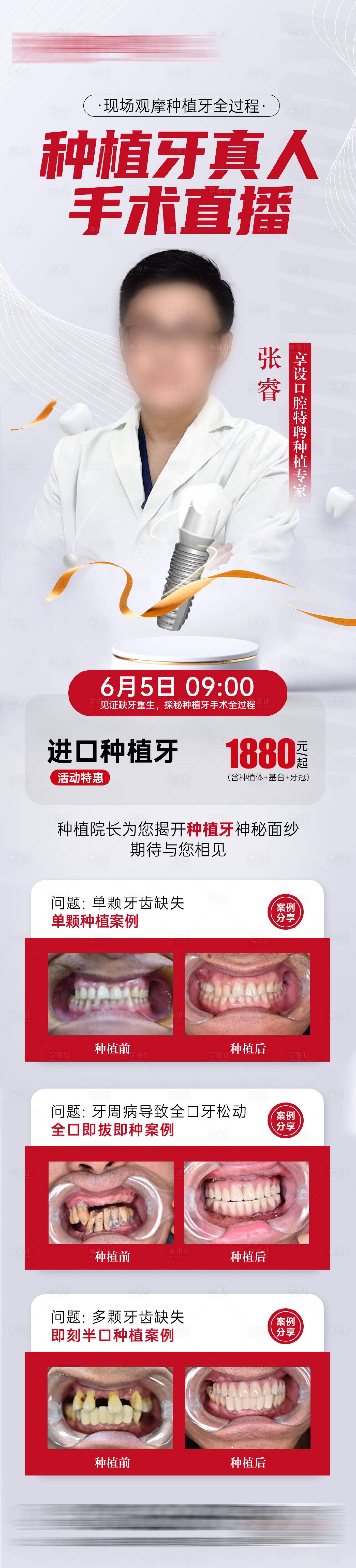 源文件下载【享设计】搜索编号：48130030959302324【种植牙直播海报】