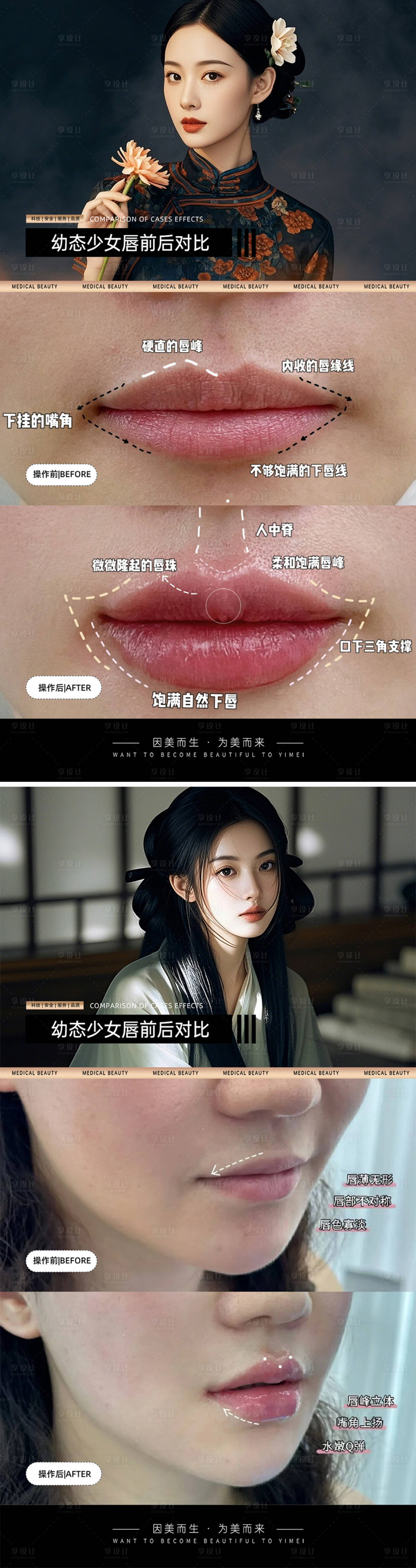 源文件下载【享设计】搜索编号：13520030826932536【医美案例对比模板】