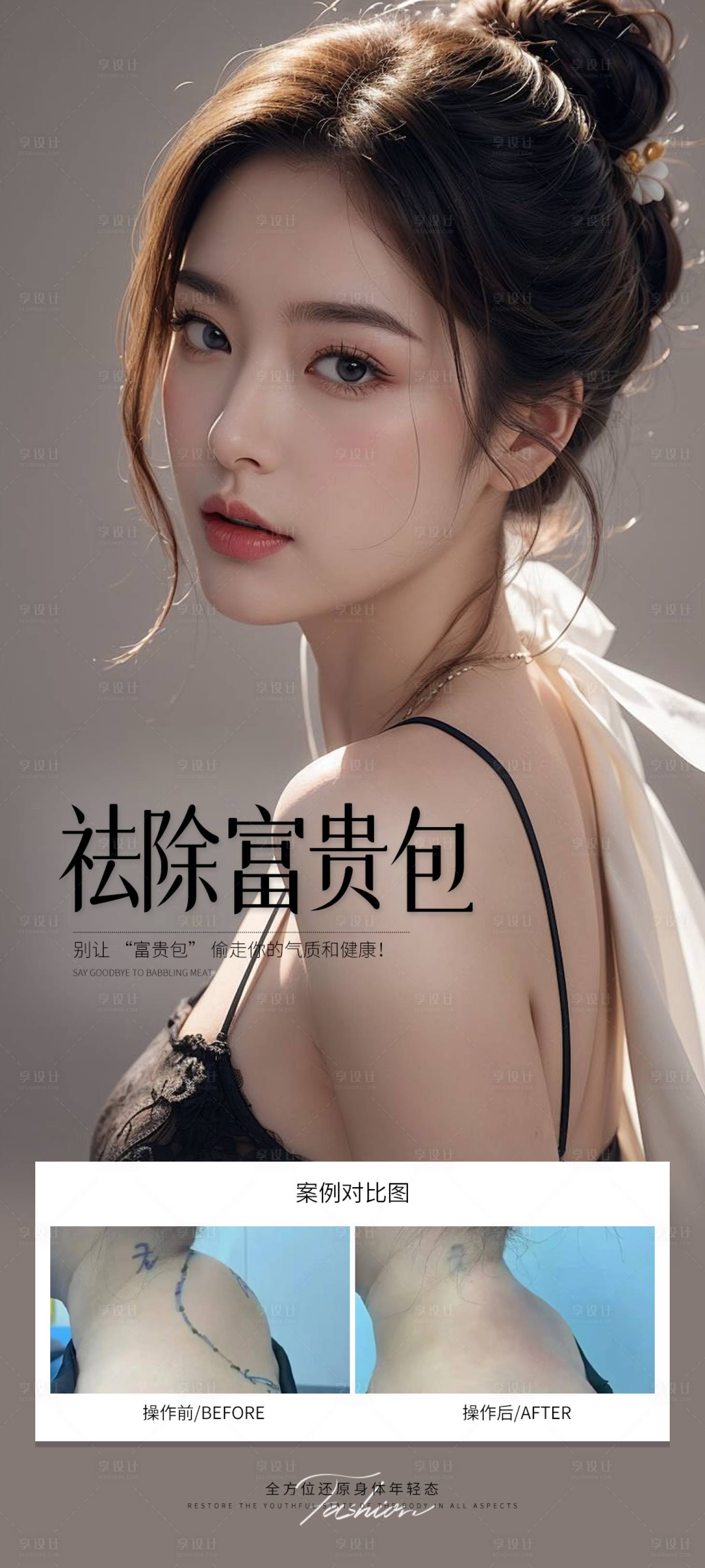 源文件下載【享設(shè)計(jì)】搜索編號(hào)：97950031633252602【祛除富貴包案例海報(bào)】