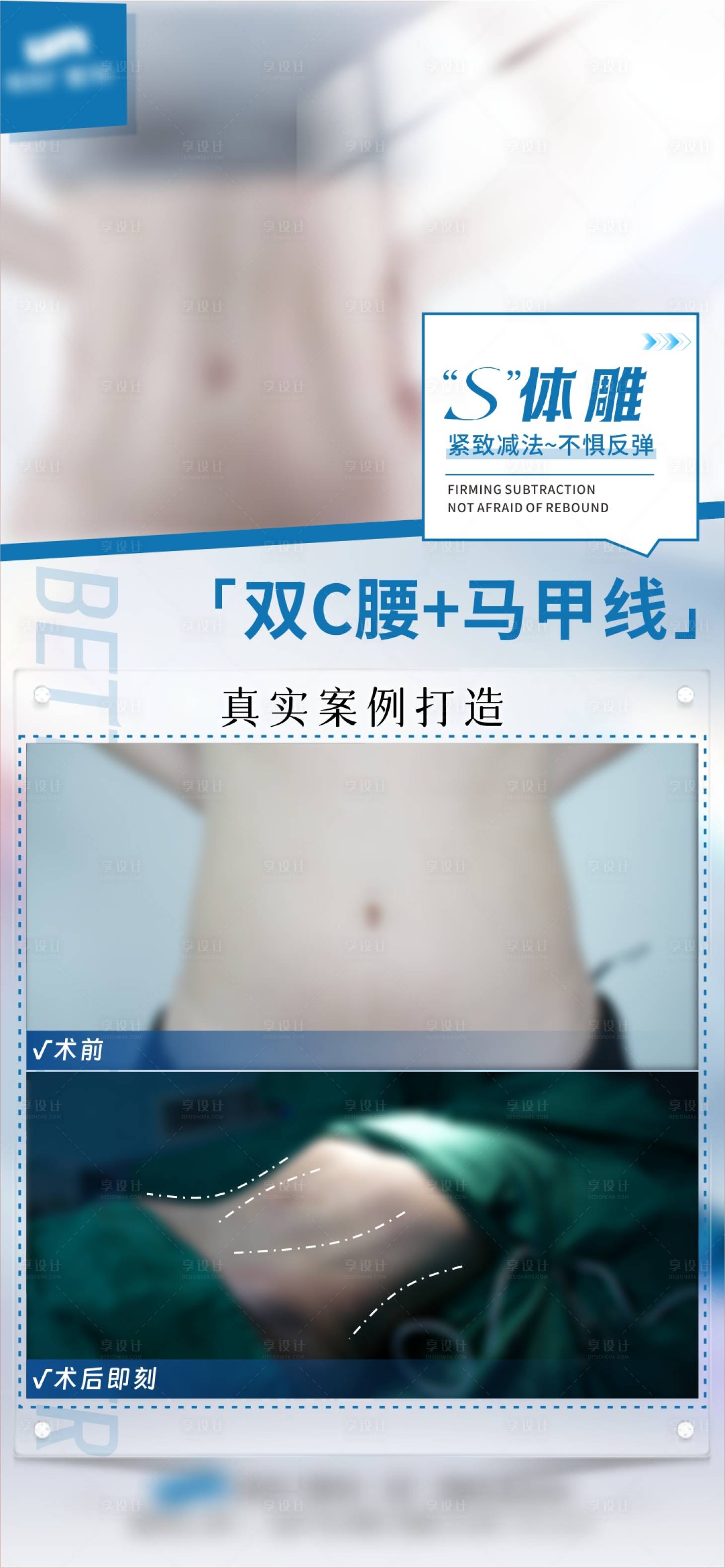 源文件下載【享設計】搜索編號：75880031410076647【體雕案例】