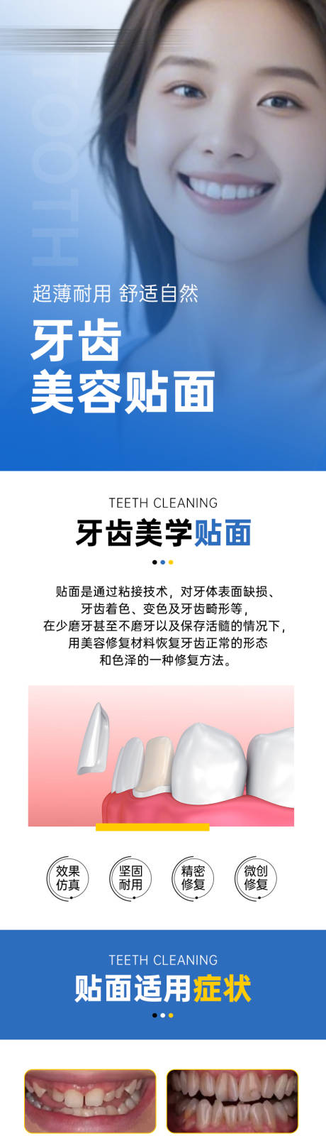 源文件下載【享設(shè)計(jì)】搜索編號(hào)：74100031127525204【牙齒貼面長(zhǎng)圖】