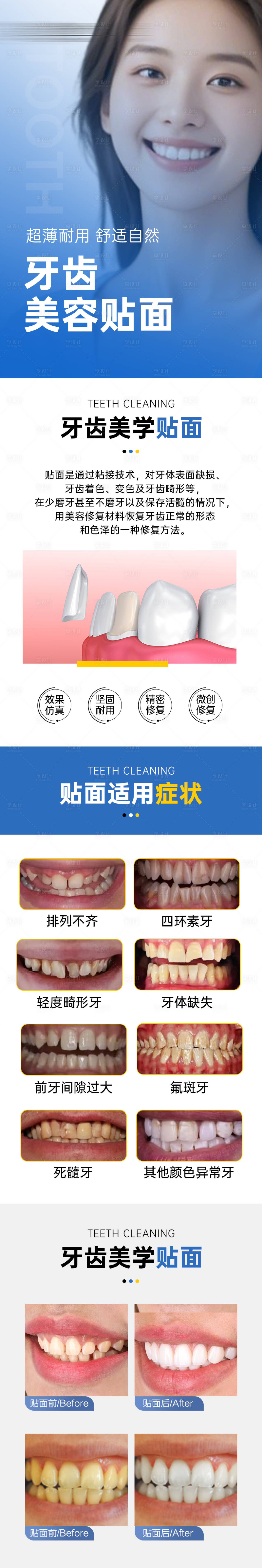 源文件下载【享设计】搜索编号：74100031127525204【牙齿贴面长图】
